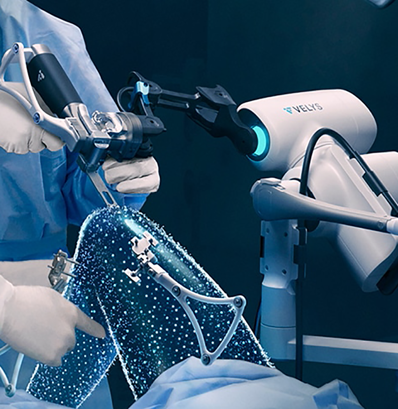 dr. grayson p. connors uses the velvys product for hip and knee replacements